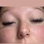 Eyelash Extension Removal