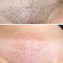 Men’s Brazilian Wax