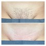 Men’s Brazilian Wax