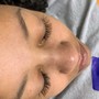 Eyelash Extension Removal