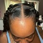 Scalp Treatment