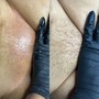 Bikini Wax