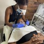 Microdermabrasion Facial