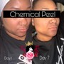 Chemical Peel Cutie