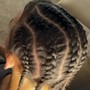 Loc Coils