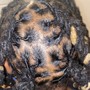 Scalp Treatment