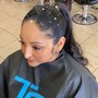 Scalp Treatment