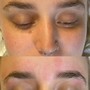 Eyelash Extension Removal