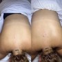 Back Facial