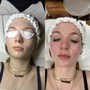 Eyelash Extension Removal