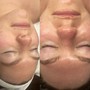 No Machine facial