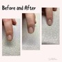 Nail Repair