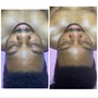 Back Facial