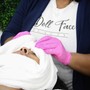 Microdermabrasion