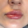 Lips- 1 ML Lip Infusion