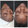 Revitalizing Back Facial