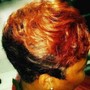 Scalp Treatment