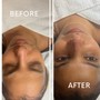 Detox Facial