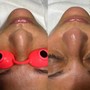 Detox Facial