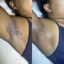 Underarm Wax