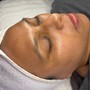 Oxygen Facial