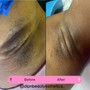 Underarm Wax