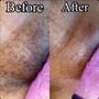 Brazilian Wax