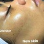 Back Facial