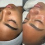 PERK - Lip HydraFacial treatment