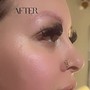 Perfect brow lift