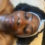 Fire & Ice Facial