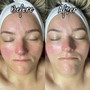 Express Facial