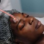 Oxygen Facial