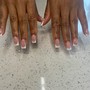 Hard gel fill (L)