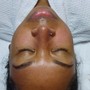 Oxygen Facial