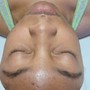 Oxygen Facial