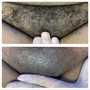 Brazilian Wax