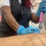 Meso Lipo Infusions