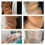 Meso Lipo Infusions