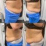 Detox Waist Wrap /Sauna /Osmotic Wrap