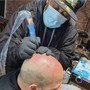 Scalp Micropigmentation