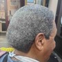 Scalp Micropigmentation