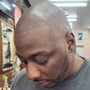 Scalp Micropigmentation