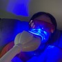 Teeth Whitening Follow Up