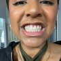 Teeth Whitening Follow Up