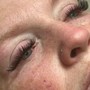 Eyelash Extension Removal