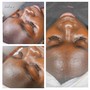 Dermaplaning Facial