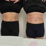 Tummy Trio Package 3 Session (50 min)