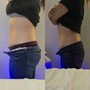 Tummy Trio Package 6 Sessions