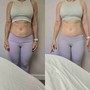 Tummy Trio Package 6 Sessions